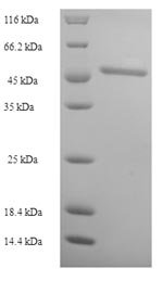 Recombinant Human 3-ketoacyl-CoA thiolase, peroxisomal (ACAA1)