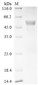 Recombinant Human Cis-aconitate decarboxylase (ACOD1)