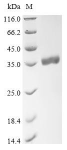 Recombinant Human Tartrate-resistant acid phosphatase type 5 (ACP5)