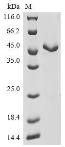 Recombinant Human Actin, aortic smooth muscle (ACTA2)