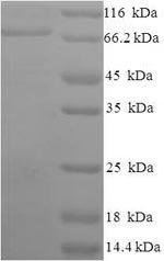 Recombinant Human Apoptosis-inducing factor 1, mitochondrial (AIFM1), partial