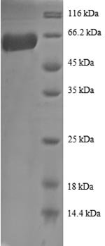 Recombinant Human Annexin A2 (ANXA2)