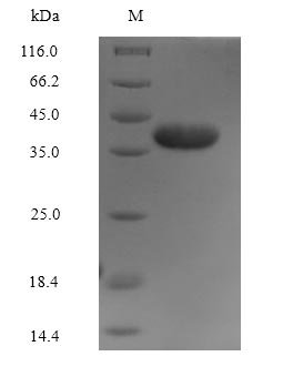 Recombinant Human Annexin A2 (ANXA2)