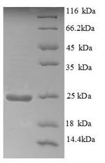 Recombinant Human Aldehyde oxidase (AOX1), partial