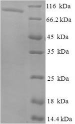 Recombinant Human Inactive N-acetylated-alpha-linked acidic dipeptidase-like protein 2 (NAALADL2), partial