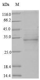 Recombinant Human Odontogenic ameloblast-associated protein (ODAM)