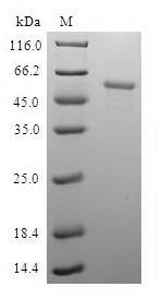 Recombinant Human Pyridoxal kinase (PDXK)