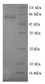 Recombinant Human N-acetylmuramoyl-L-alanine amidase (PGLYRP2)