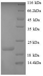 Recombinant Human Plexin-A1 (PLXNA1), partial