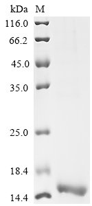 Recombinant Human Ras-related protein Rab-10 (RAB10)