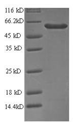 Recombinant Human Antiviral innate immune response receptor RIG-I (RIGI), partial