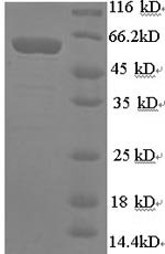 Recombinant Human Synapsin-1 (SYN1), partial