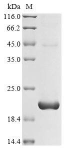 Recombinant Human T cell receptor beta constant 1 (TRBC1), partial