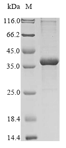 Recombinant Human Tau-tubulin kinase 2 (TTBK2), partial