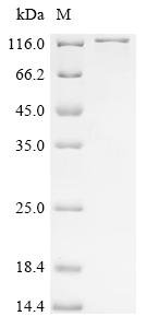 Recombinant Human Ubiquitin carboxyl-terminal hydrolase 43 (USP43)