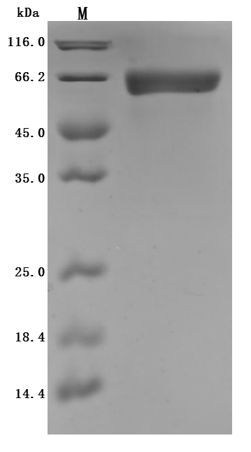Recombinant Rat Intestinal-type alkaline phosphatase 1 (Alpi) (Active)