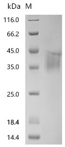 Recombinant Mouse Asialoglycoprotein receptor 1 (Asgr1), partial