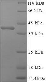 Recombinant Mouse Complement C1q subcomponent subunit A (C1qa)