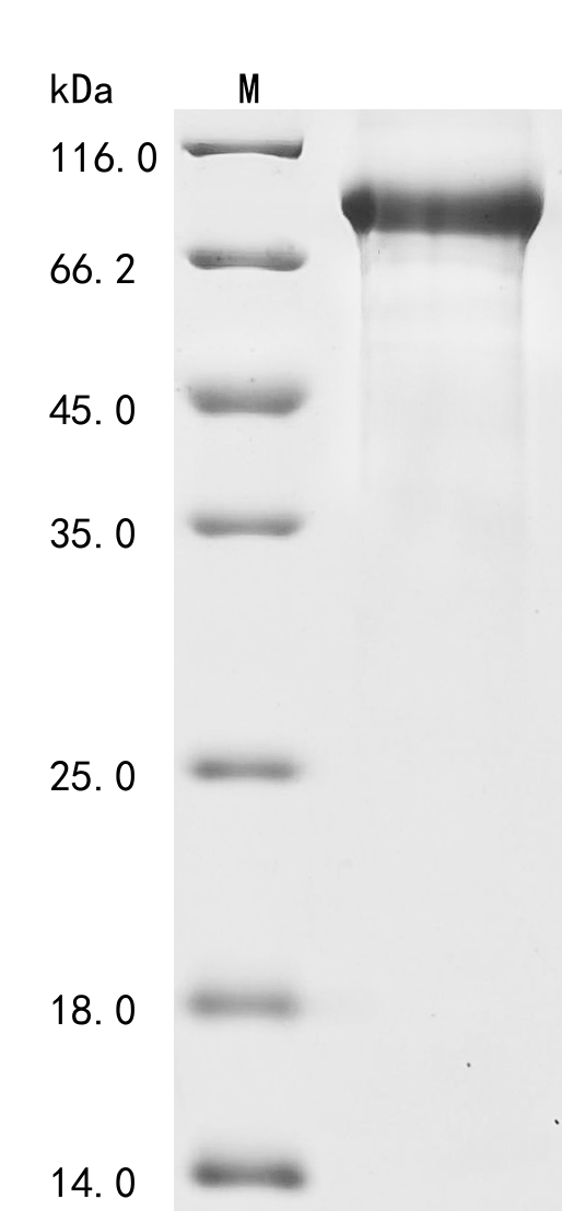 Recombinant Mouse Complement C1s-1 subcomponent (C1s1)