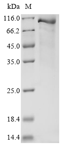 Recombinant Mouse Complement C1s-B subcomponent (C1sb)