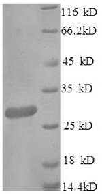 Recombinant Mouse Scavenger receptor cysteine-rich type 1 protein M130 (Cd163), partial