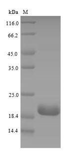 Recombinant Mouse Complement receptor type 2 (Cr2), partial