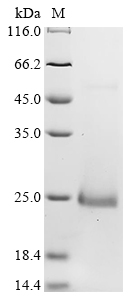 Recombinant Mouse C-X-C motif chemokine 15 (Cxcl15)