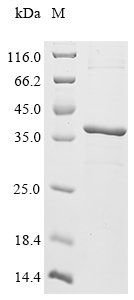 Recombinant Mouse Deoxyribonuclease gamma (Dnase1l3)