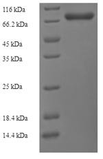 Recombinant Bacteroides vulgatus Alpha-1,3-galactosidase B (glaB1)