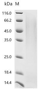 Recombinant Rat Glucagon-like peptide 1 receptor (Glp1r), partial