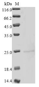 Recombinant Mouse Heme-binding protein 1 (Hebp1)