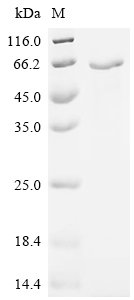 Recombinant Sendai virus Hemagglutinin-neuraminidase (HN), partial