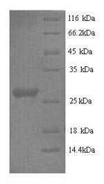 Recombinant Rabbit Interleukin-6 (IL6)