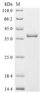Recombinant Mouse Monoglyceride lipase (Mgll)