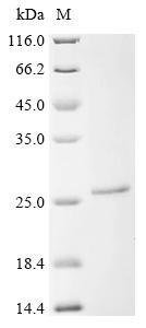 Recombinant Mouse Cytochrome c oxidase subunit 2 (Mtco2), partial