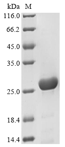 Recombinant Chlamydia trachomatis Virulence plasmid protein pGP3-D