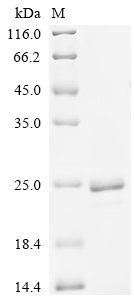 Recombinant Streptococcus agalactiae serotype V Nucleoside diphosphate kinase (ndk)