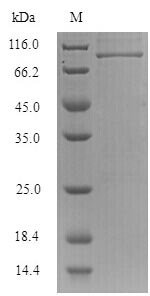 Recombinant Influenza B virus Nucleoprotein (NP)