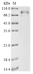 Recombinant Mouse cGMP-dependent protein kinase 1 (Prkg1)