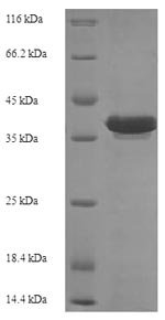 Recombinant Escherichia coli Recombination protein RecR (recR)