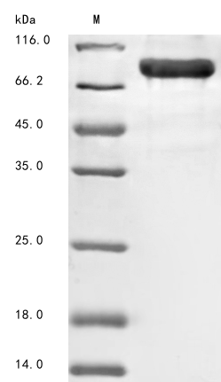 Recombinant Mouse Receptor-interacting serine/threonine-protein kinase 1 (Ripk1)