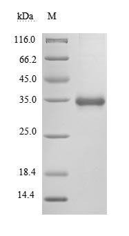 Recombinant Severe acute respiratory syndrome coronavirus 2 Spike glycoprotein (S), partial (Active)