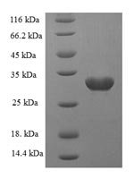 Recombinant Rat Sortilin (Sort1), partial