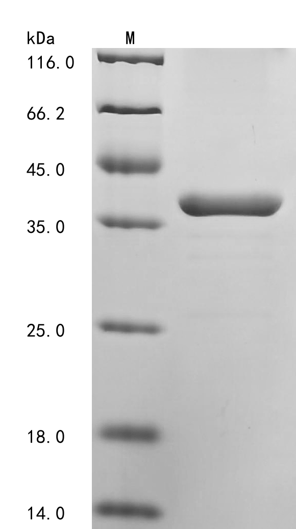 Recombinant Rat Transferrin receptor protein 1 (Tfrc), partial