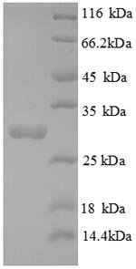 Recombinant Mouse Tryptase (Tpsab1), partial