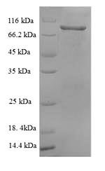 Recombinant Rat Vascular cell adhesion protein 1 (Vcam1), partial