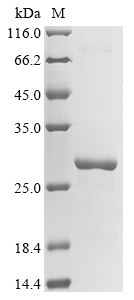 Recombinant Escherichia coli O6:H1 Phosphodiesterase yfcE (yfcE)