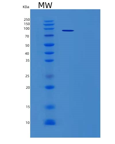 Recombinant Human Complement Factor B/CFB Protein