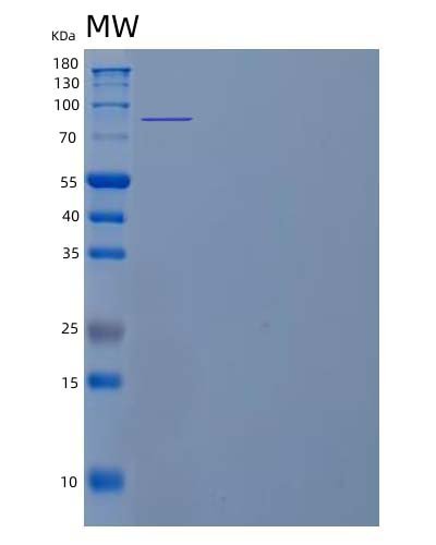 Recombinant Human Angiotensin-Converting Enzyme 2/ACE-2 Protein
